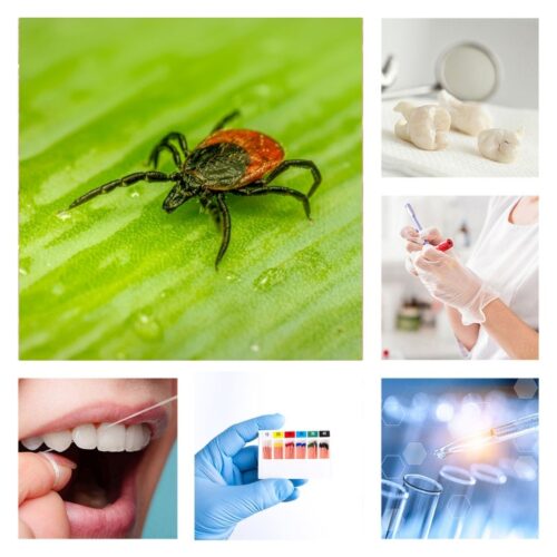 DNA ConneXions Comprehensive Oral Test & Lyme Disease Test Combo