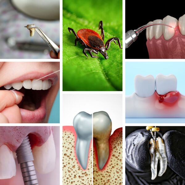 DNA ConneXions Comp Oral Lyme Test Combo Sample Types Image