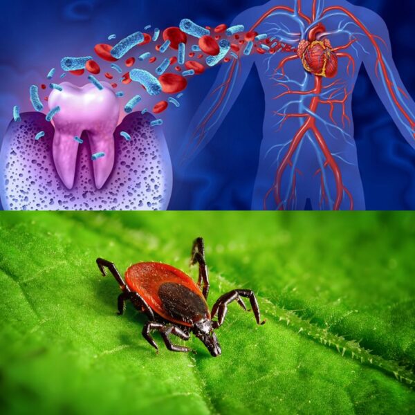 DNA ConneXions Periodontal Lyme Disease Test Combo Image