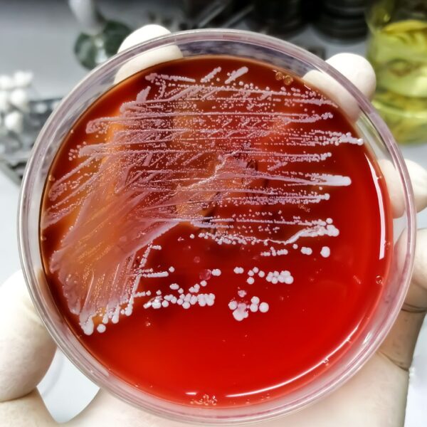 DNA ConneXions Staph Strep Test