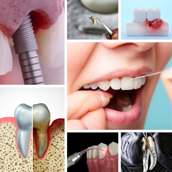 Comprehensive Oral Test Sample Types