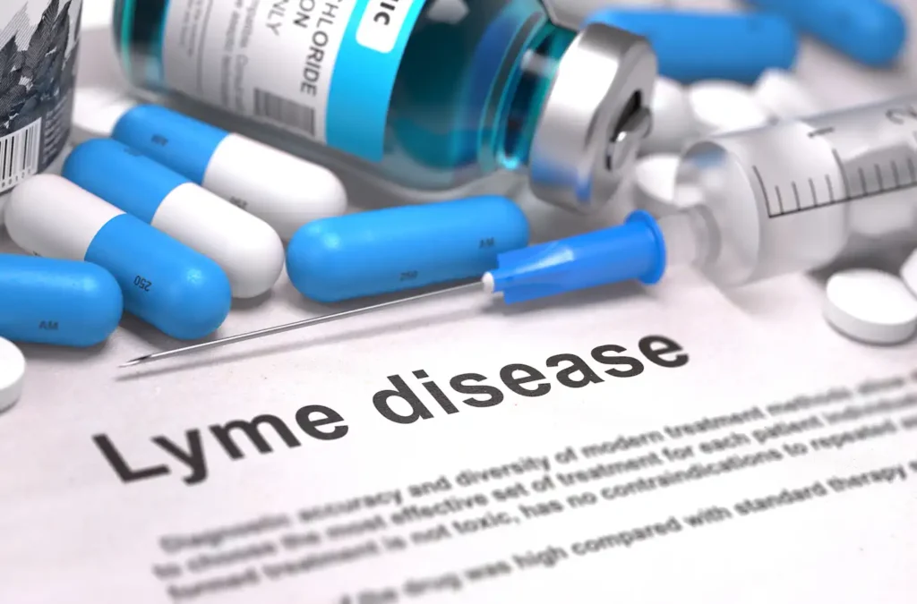 Lyme disease medication can either be oral antibiotics or IV antibiotics.